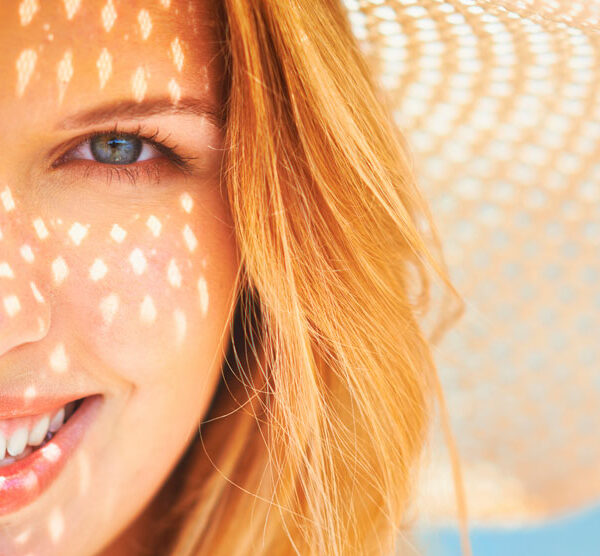 ¿Cansada de las manchas solares?