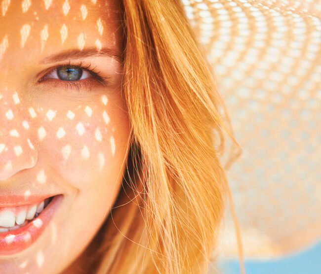 ¿Cansada de las manchas solares?