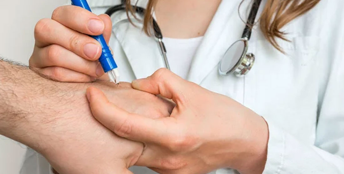 Importancia del abordaje temprano