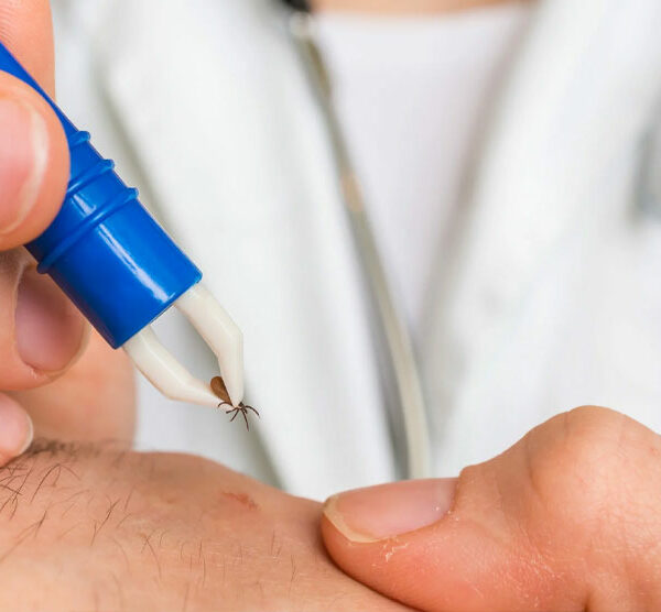 ¿Qué es la enfermedad de Lyme?