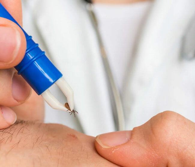 ¿Qué es la enfermedad de Lyme?