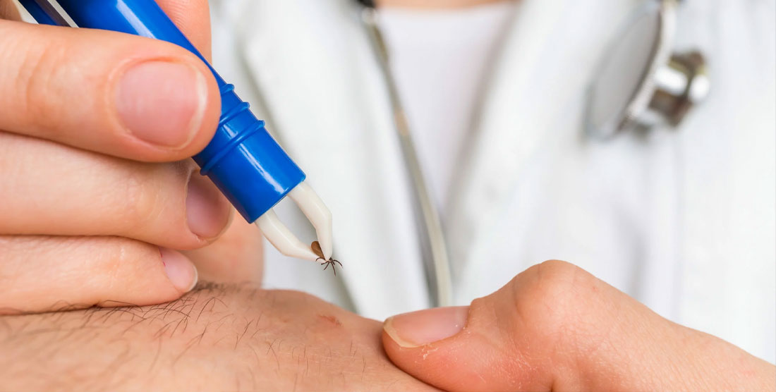 ¿Qué es la enfermedad de Lyme?